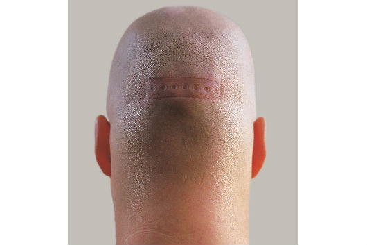 Koronczi Endre: Testnyomatok